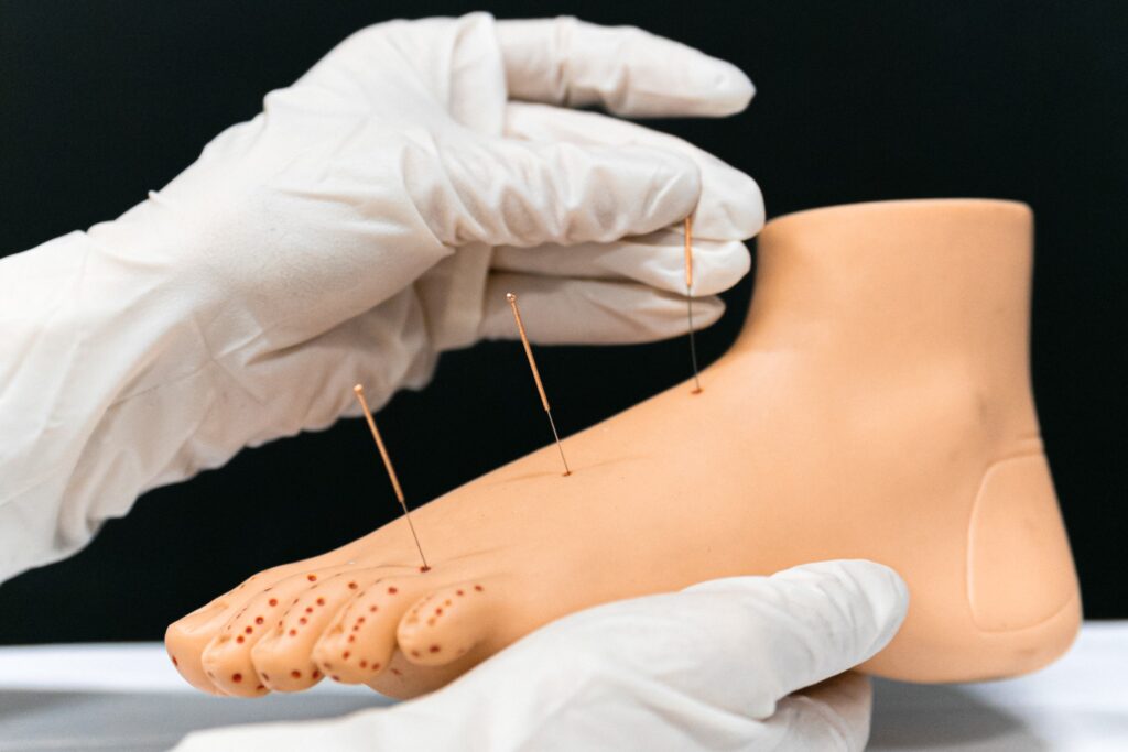 Acupuntura Taubaté